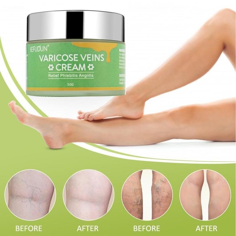 Skin Care Lotion Varicose Cream - Olive Eden